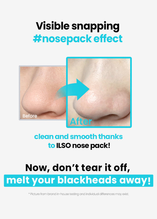 ilso Natural Mild Clear Nose Pack