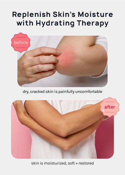A+ Gel Lined Heel and Elbow Spa Cover