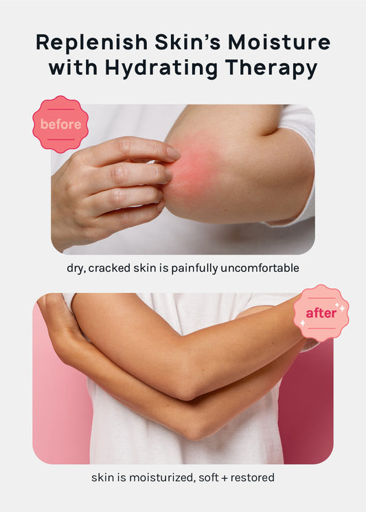 A+ Gel Lined Heel and Elbow Spa Cover