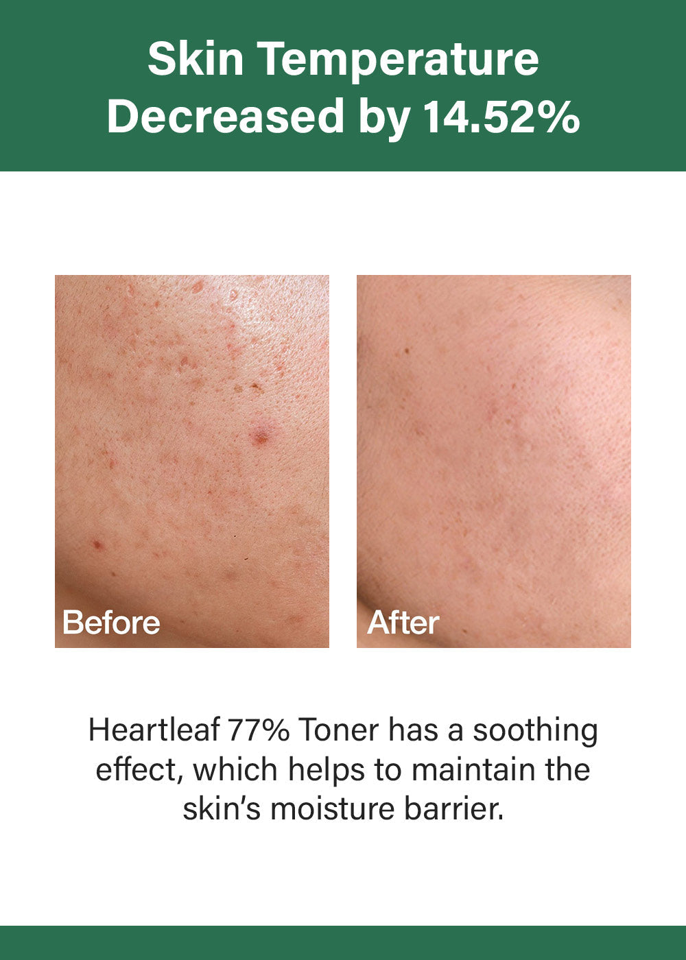 Anua Heartleaf 77 Soothing Toner 250ml