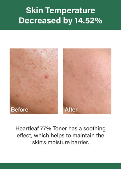 Anua Heartleaf 77 Soothing Toner 250ml