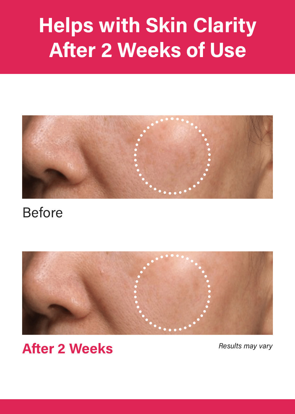 Anua Niacinamide 10% + TXA 4% Serum 30ml