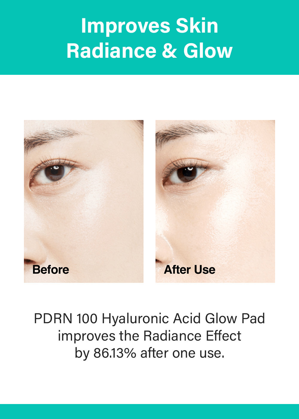 Anua PDRN 100 Hyaluronic Acid Glow Pad (60 Pads)