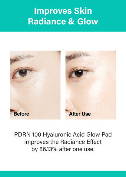 Anua PDRN 100 Hyaluronic Acid Glow Pad (60 Pads)