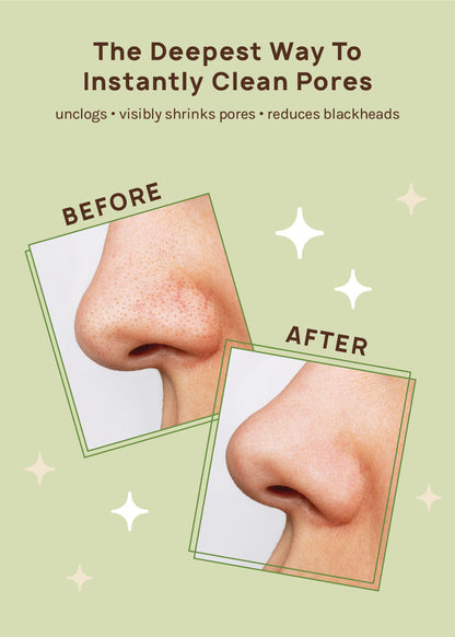 AOA Skin Charcoal Nose Strip