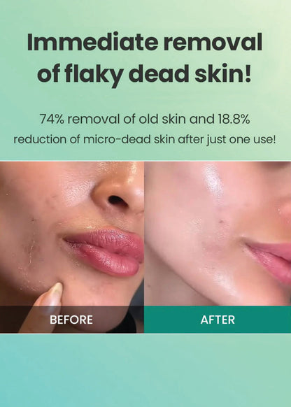 Dr.G Brightening Peeling Gel 120g