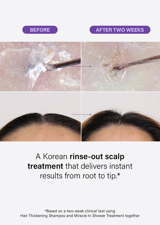 Dr. Groot Scalp Revitalizing Solution Miracle in Shower Treatment 250ml