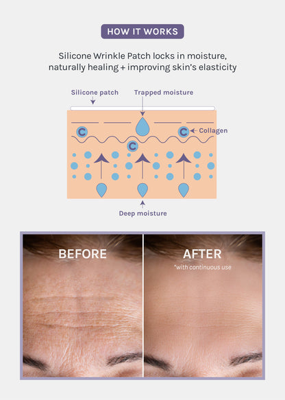 AOA Skin Wrinkle Smoothing Patches – Eyes