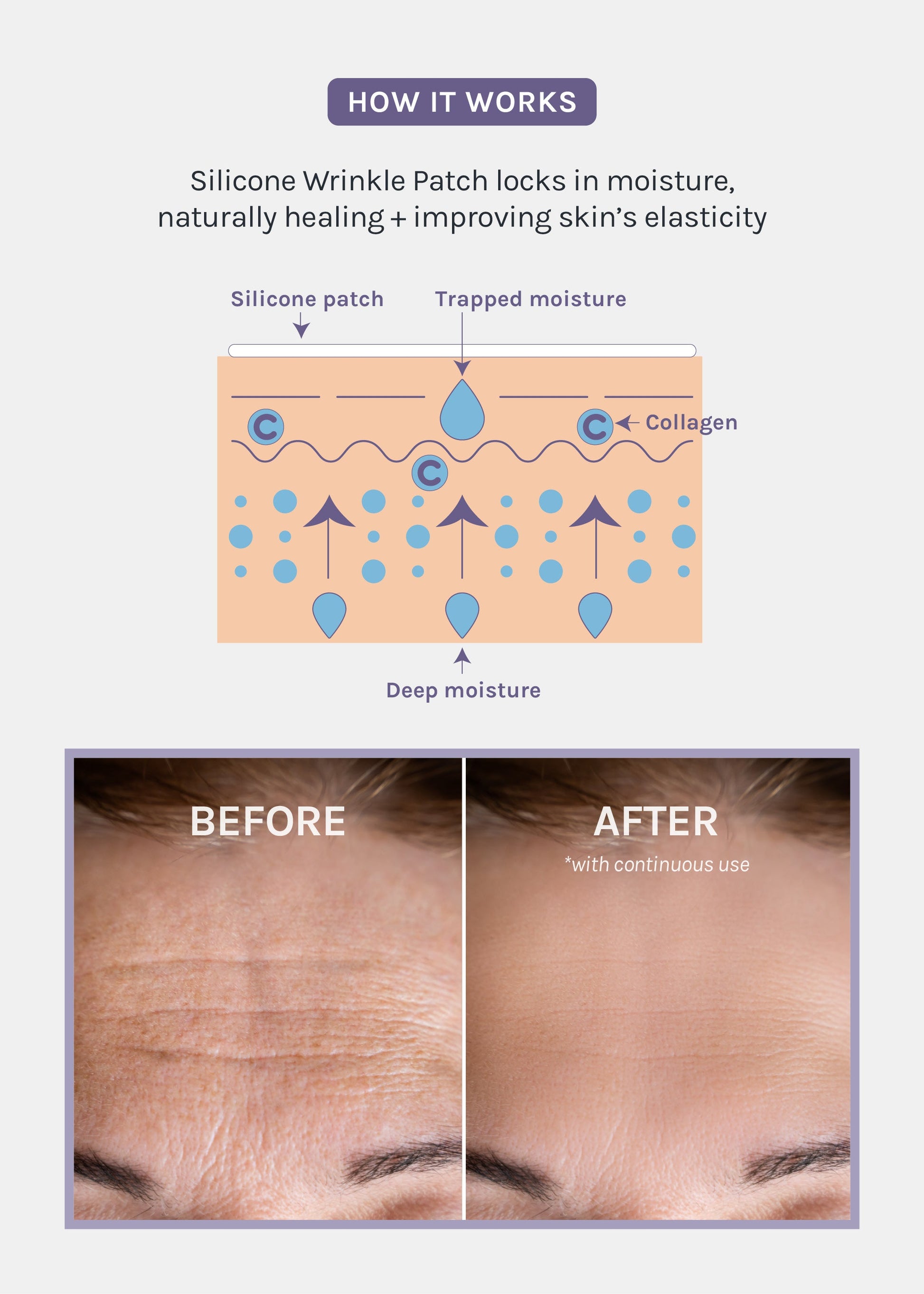 AOA Skin Wrinkle Smoothing Patch – Forehead