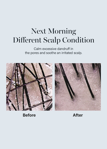 GROWUS Damage Therapy Scalp Scaling Ampoule 50ml