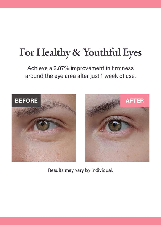 medicube PDRN Pink Peptide Eye Cream 30ml