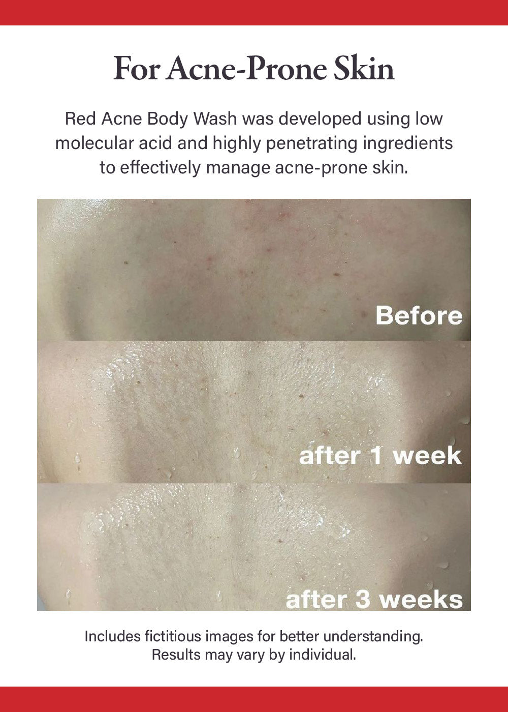 medicube Red Body Wash 400g
