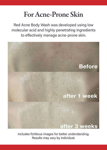 medicube Red Body Wash 400g
