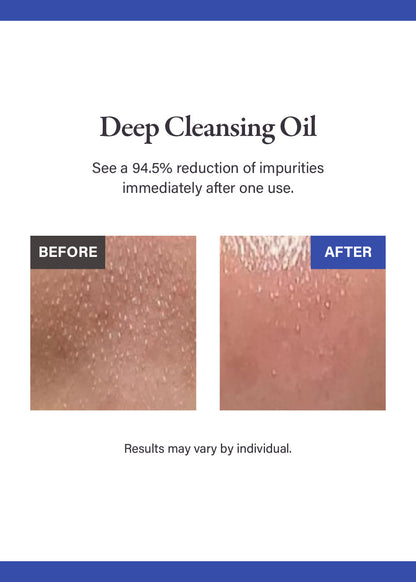 medicube Zero Pore Blackhead Deep Cleansing Oil 205ml