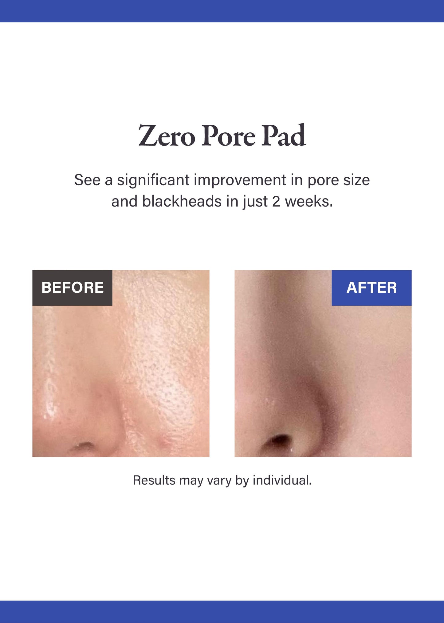 medicube Zero Pore Pad 2.0 (70 Pads)