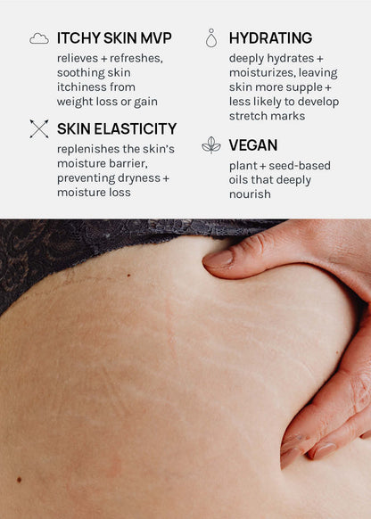 AOA Skin Natural Stretch Mark Body Oil