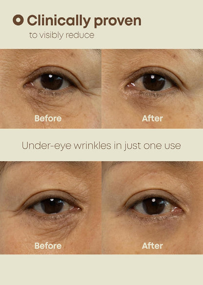 NINELESS Ever-Youth Dual Effect Eye Cream 20ml