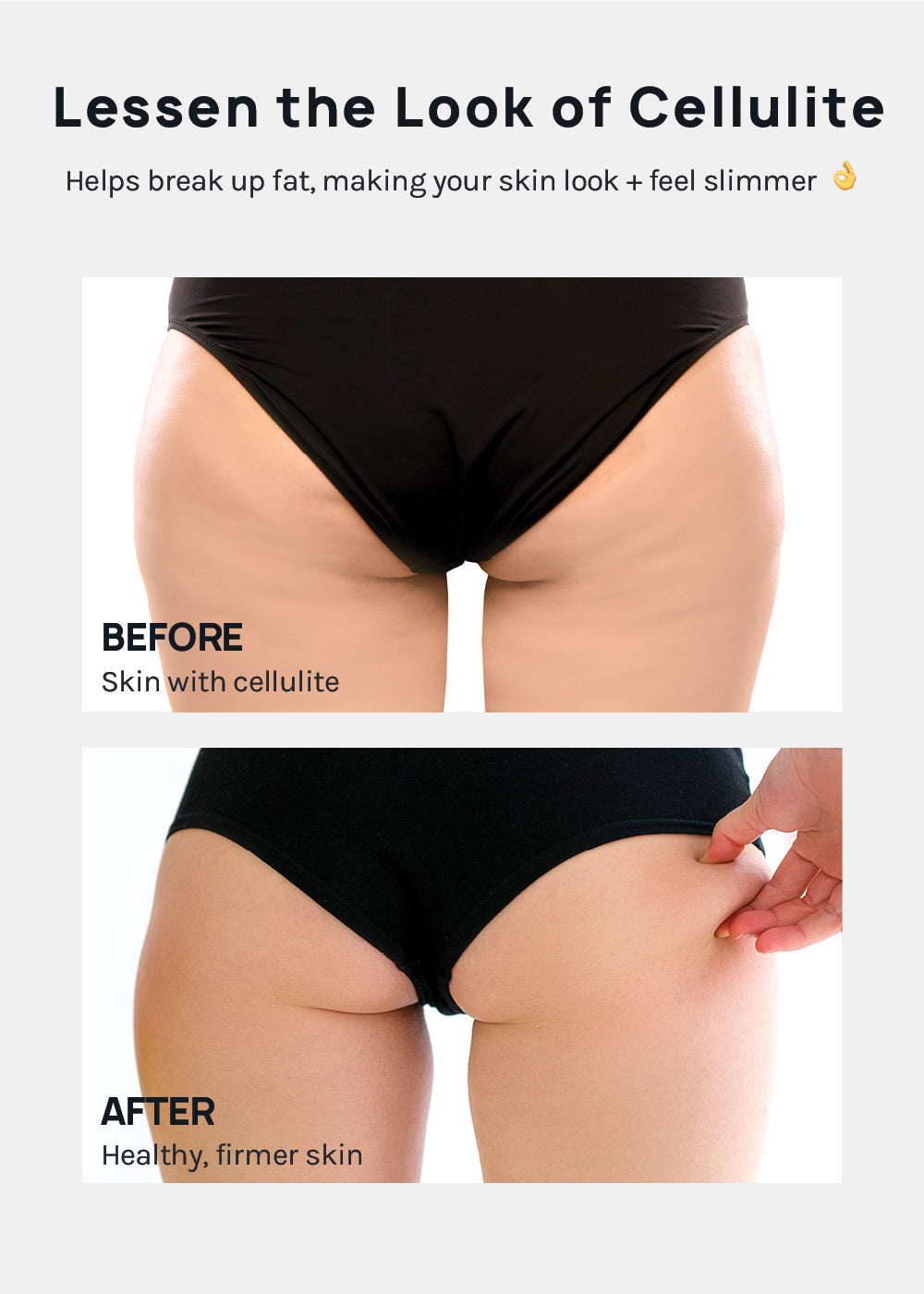 A+ Cellulite Massage Roller