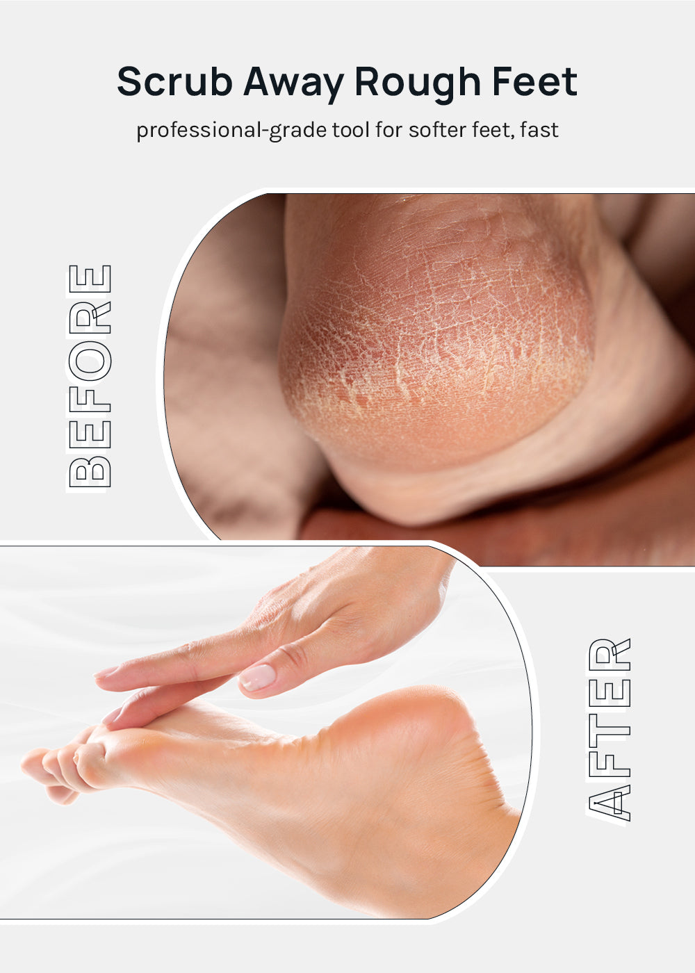 AOA Double-Sided Pedicure File