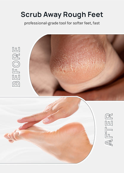AOA Double-Sided Pedicure File