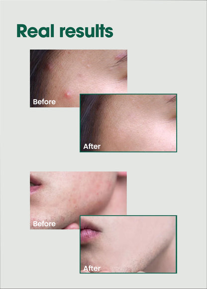 SOME BY MI AHA.BHA.PHA 30 Days Miracle Serum 50ml