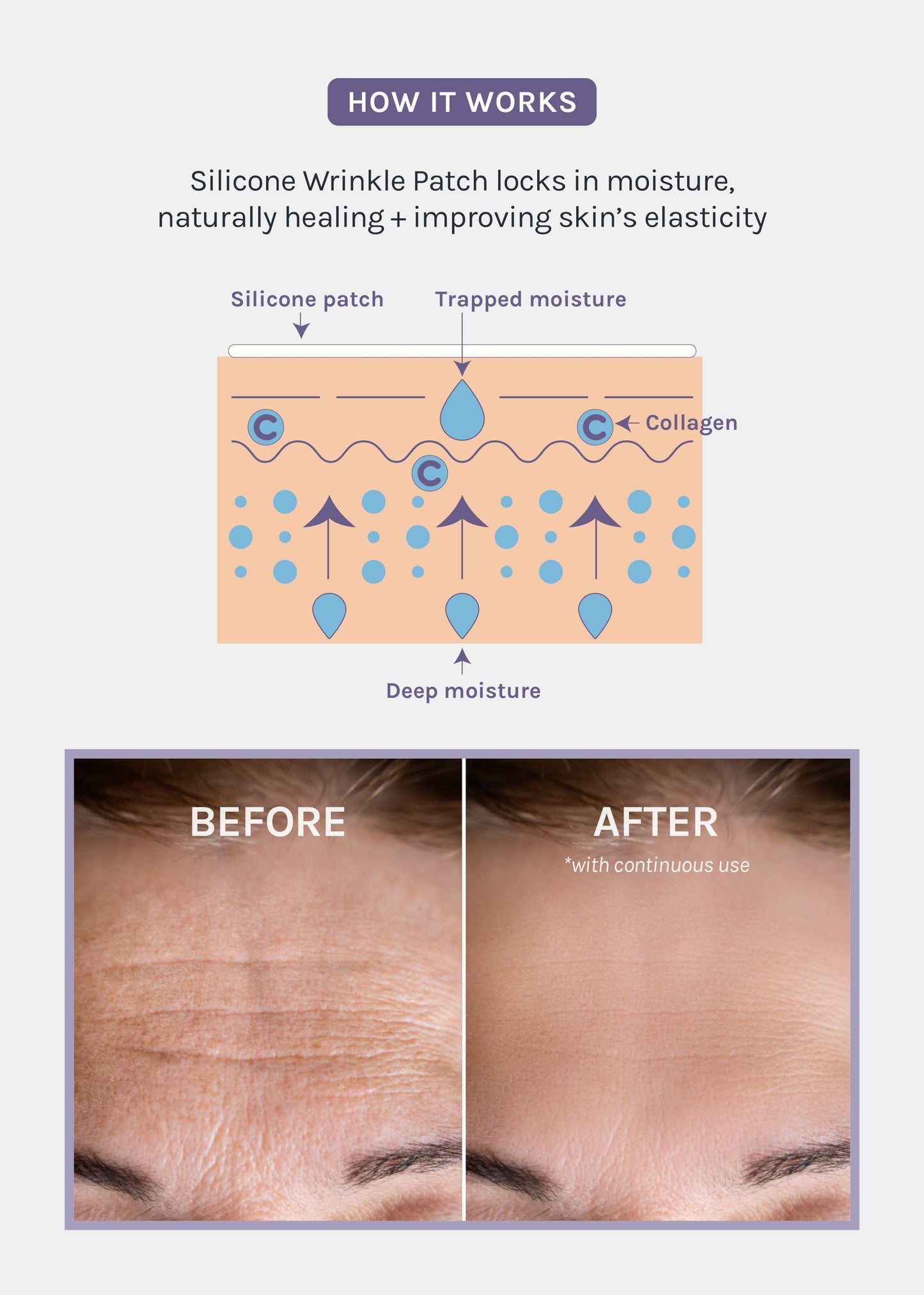 AOA Skin Wrinkle Smoothing Patches – Smile Line